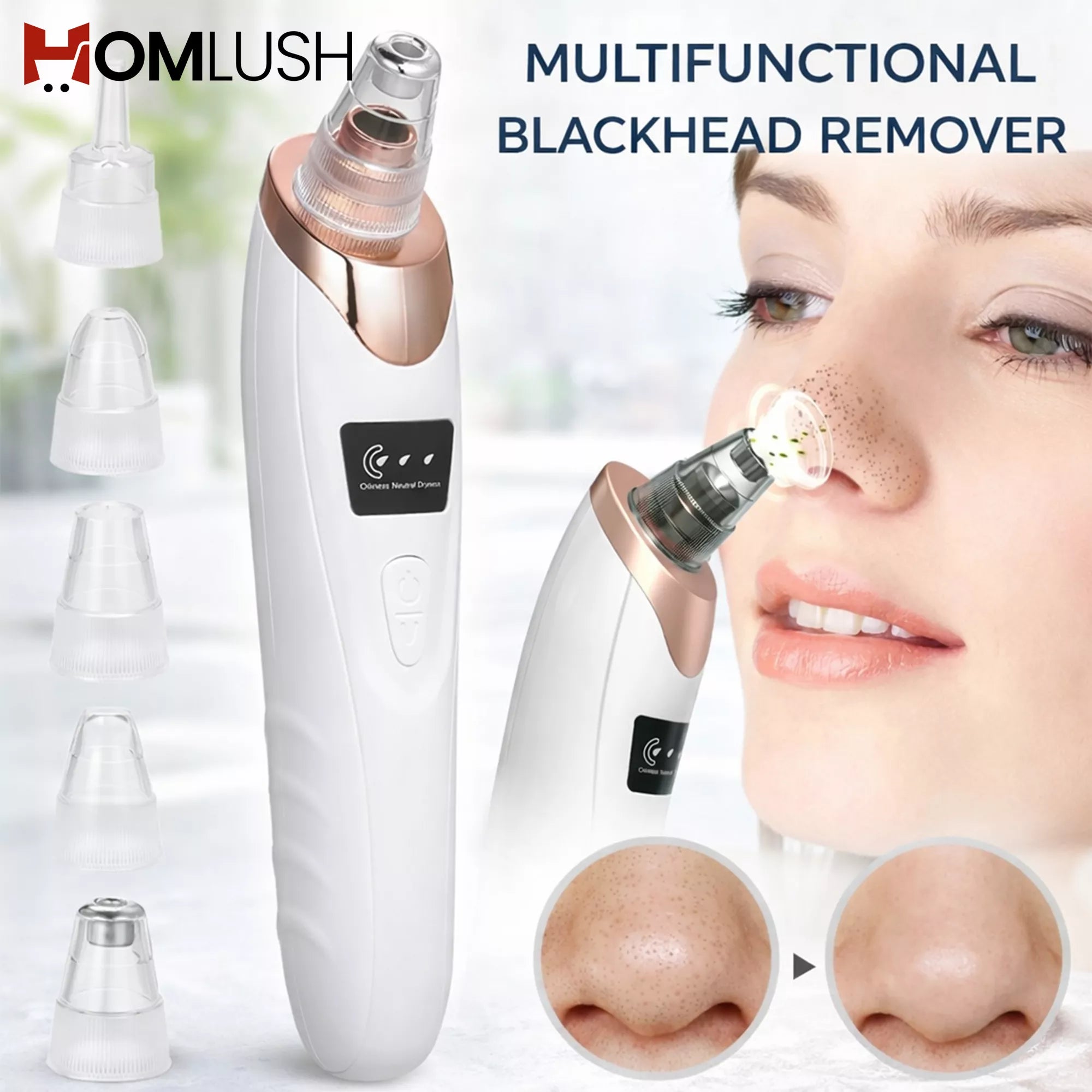Rechargeable blackhead removal vacuum machine
